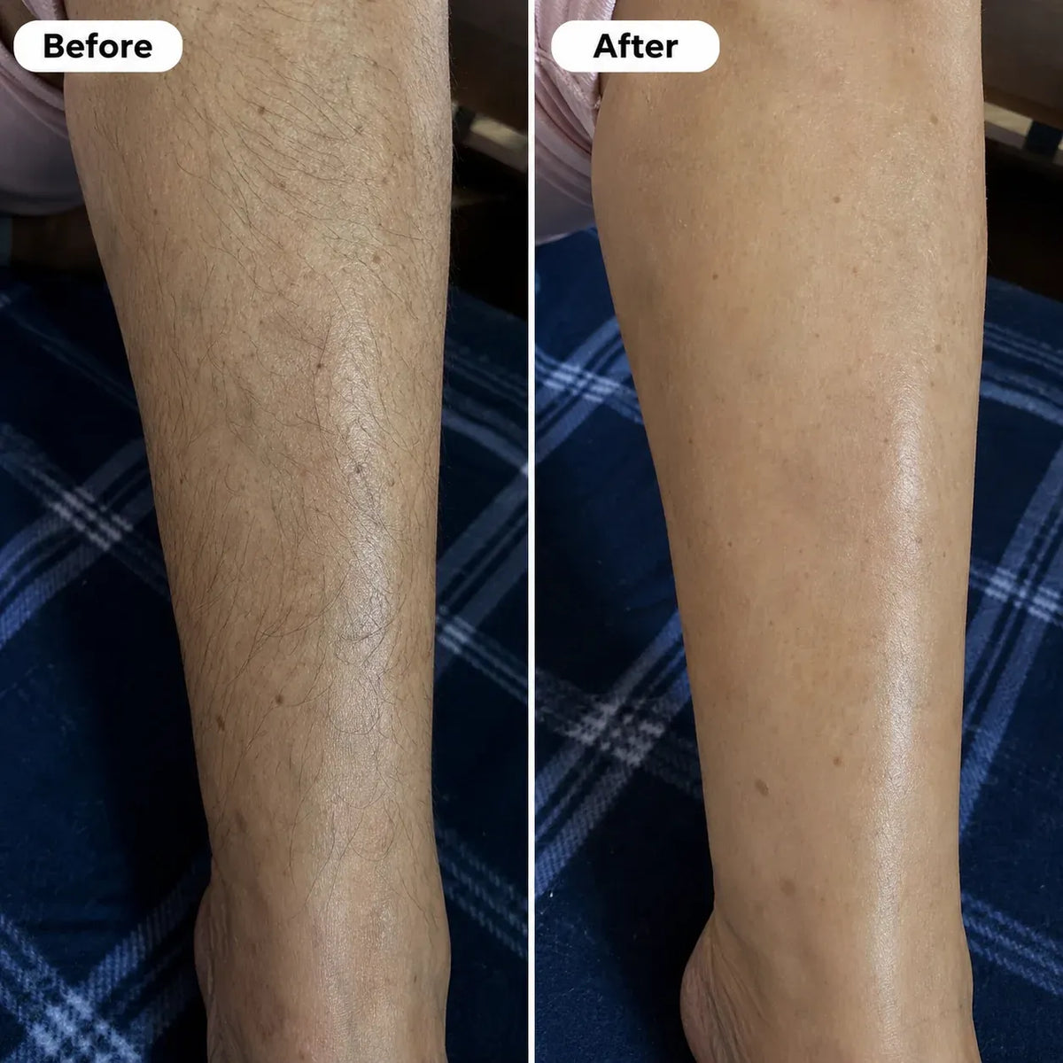 Smoothed Hair Removal Cream