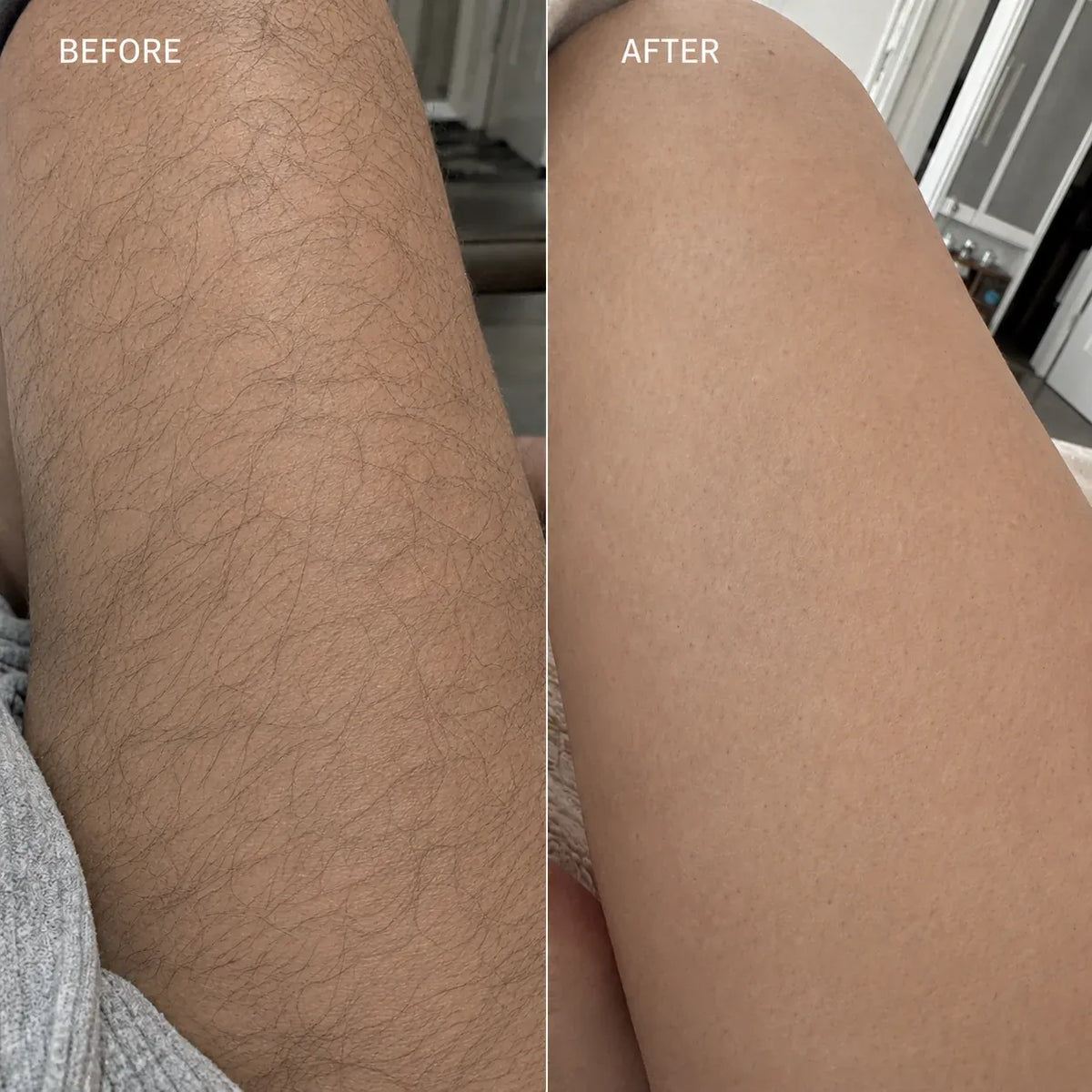 Smoothed Hair Removal Cream